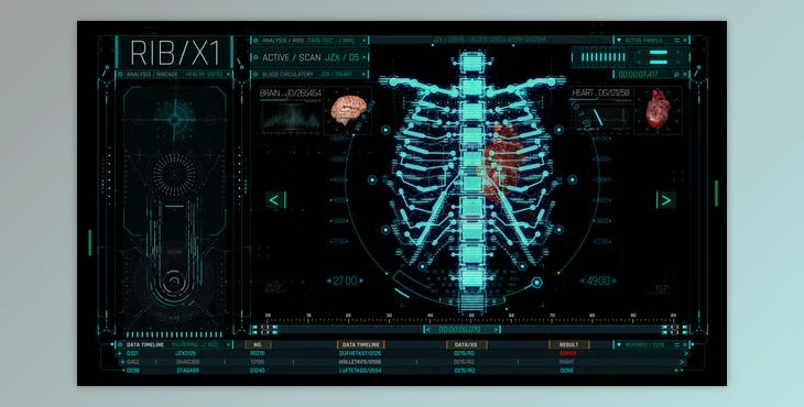 Download HUD Medical Ribs (Videohive 53687975) - AE Project