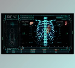 Download HUD Medical Ribs (Videohive 53687975) - AE Project